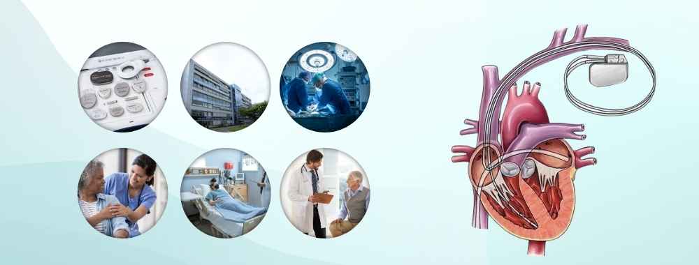 factors affecting the cost of icd implantation