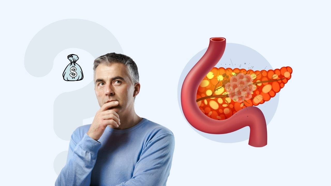 factors that may affect the cost of pancreatic cancer treatment