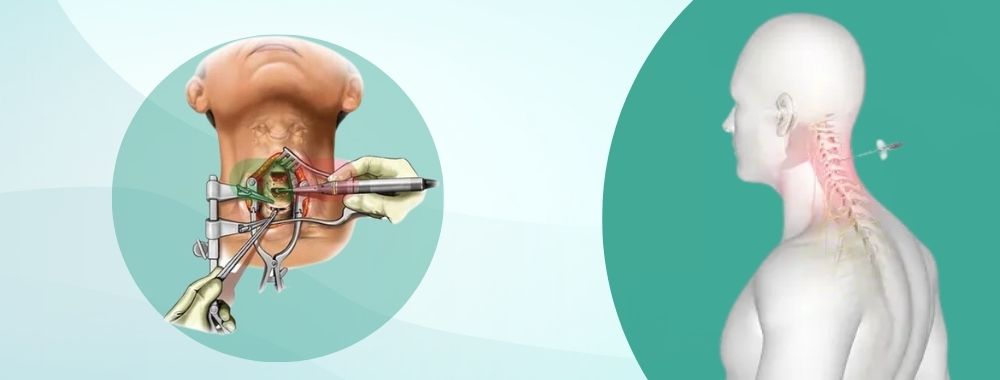 technologies used in india for cervical spine surgery