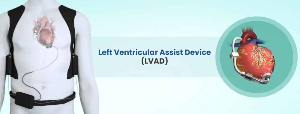 left ventricular assist device (lvad) cost in india