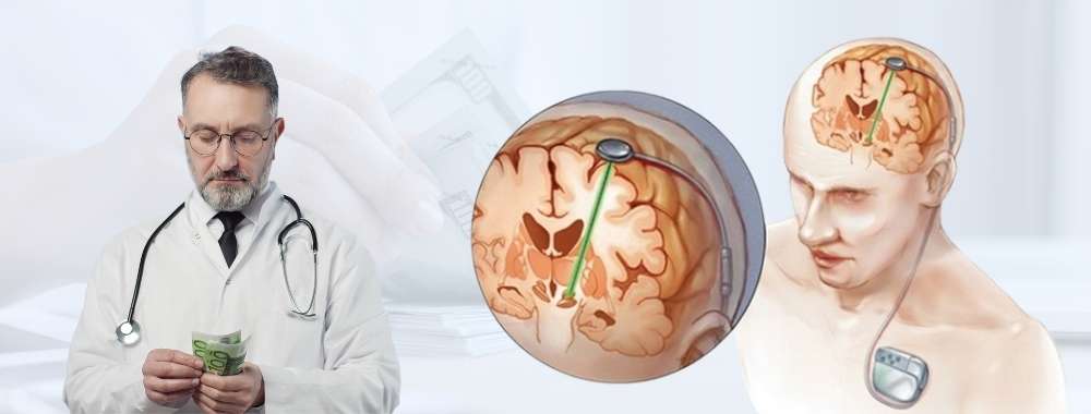 factors affecting the cost of dbs surgery
