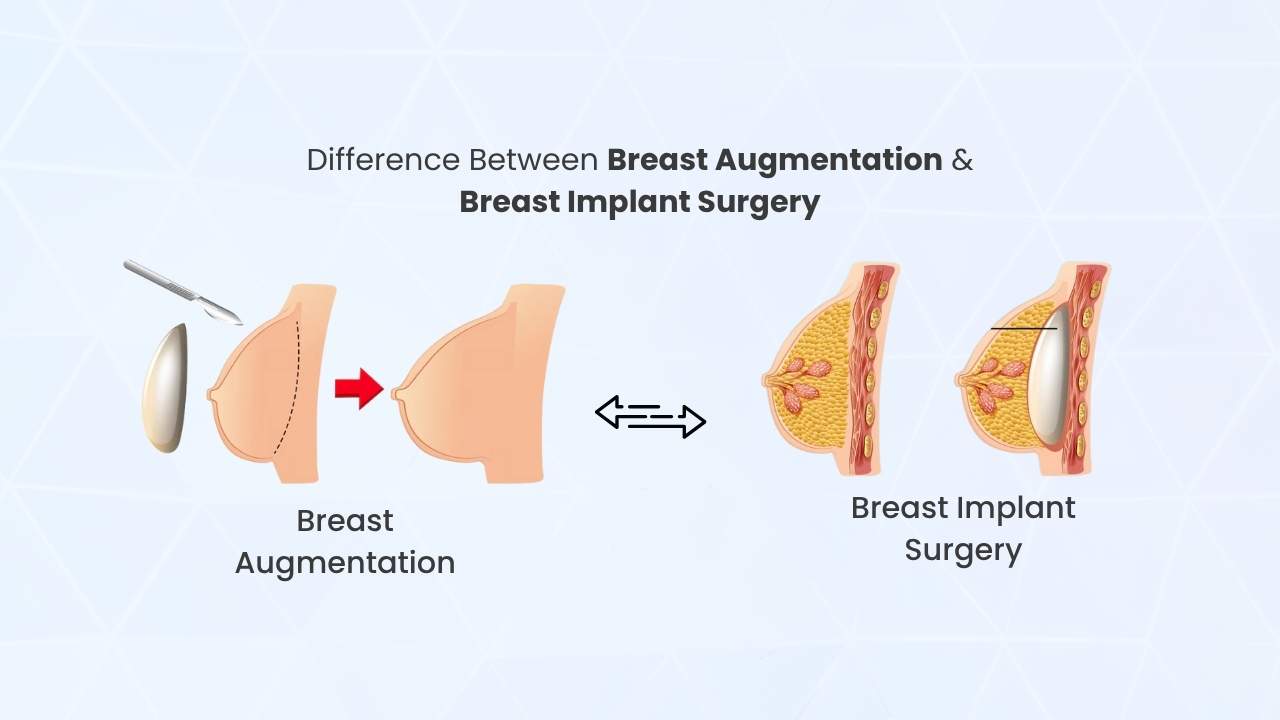 difference between breast augmentation & breast implant