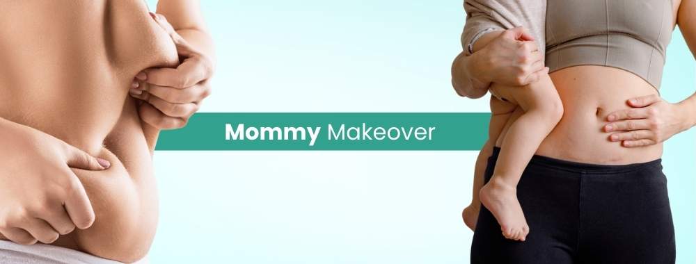 mommy-makeover-cost-in-india