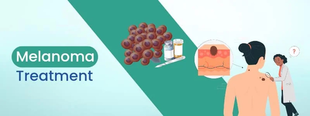 melanoma cancer treatment cost in india