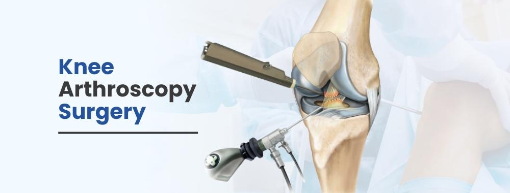 knee arthroscopy surgery cost in india