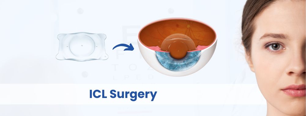 ICL surgery cost in india