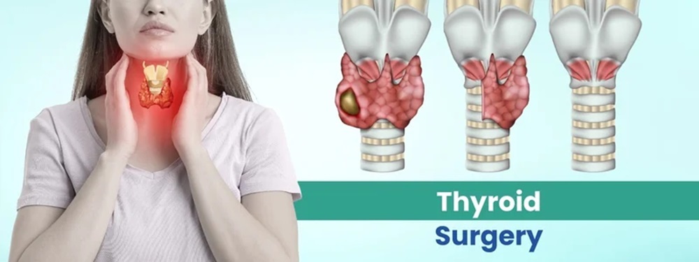 thyroid surgery cost in india