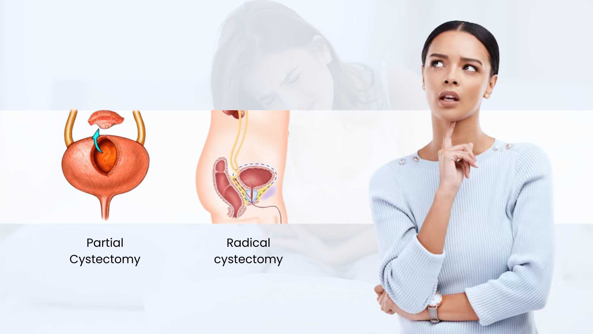 types of cystectomy