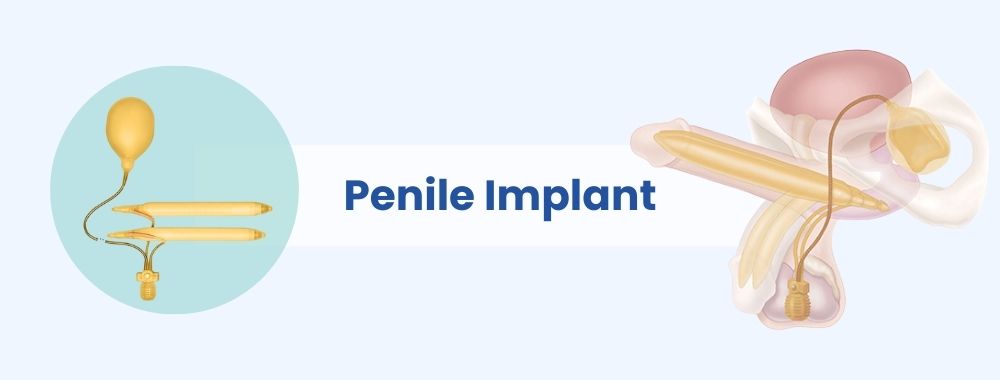 penile implant cost in india