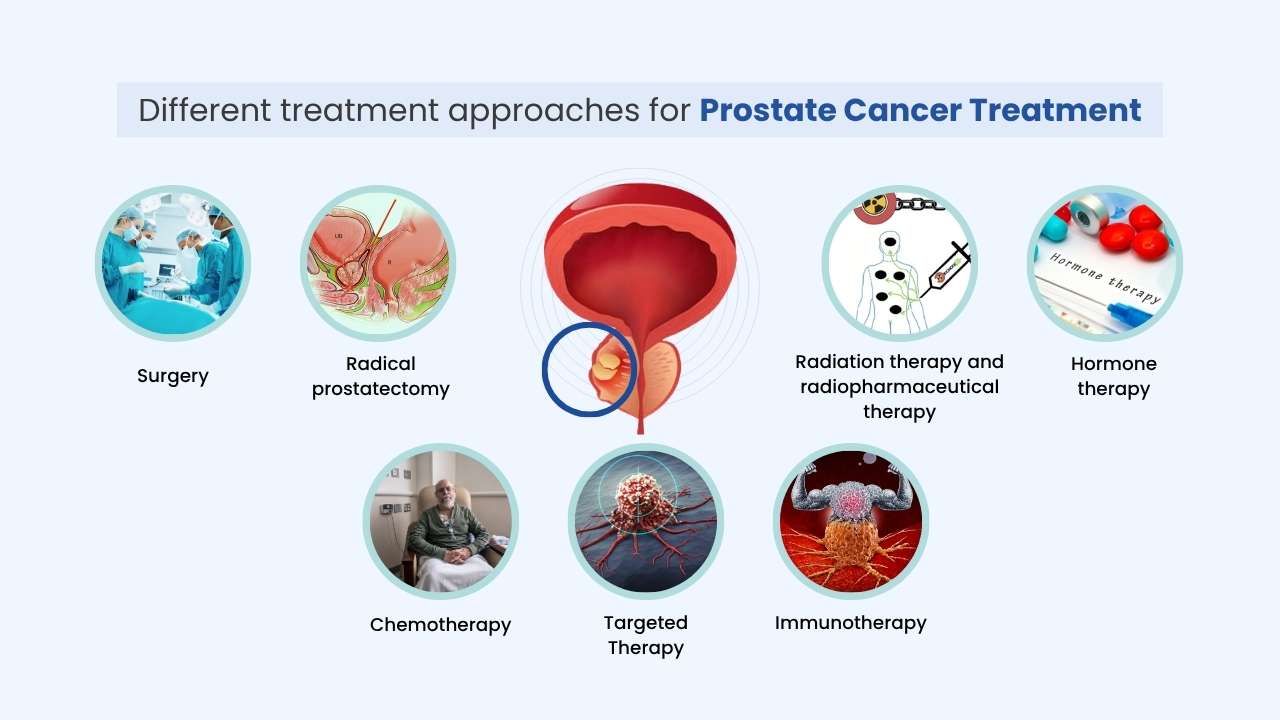 how prostate cancer treatment is done