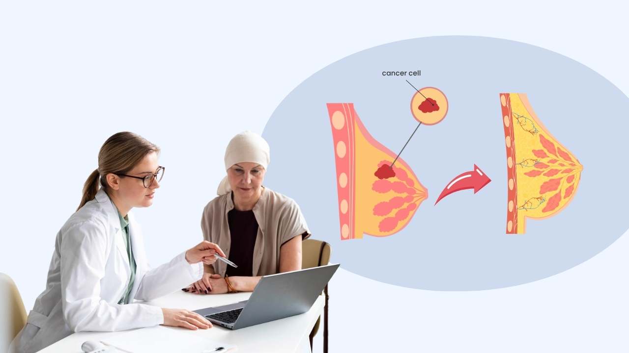 why breast cancer treatment performed