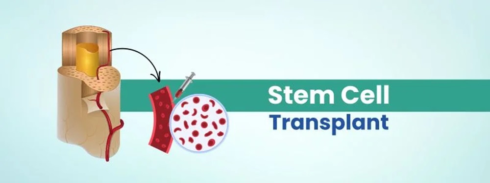 Stem Cell Transplant Cost in India | RIHLATMED