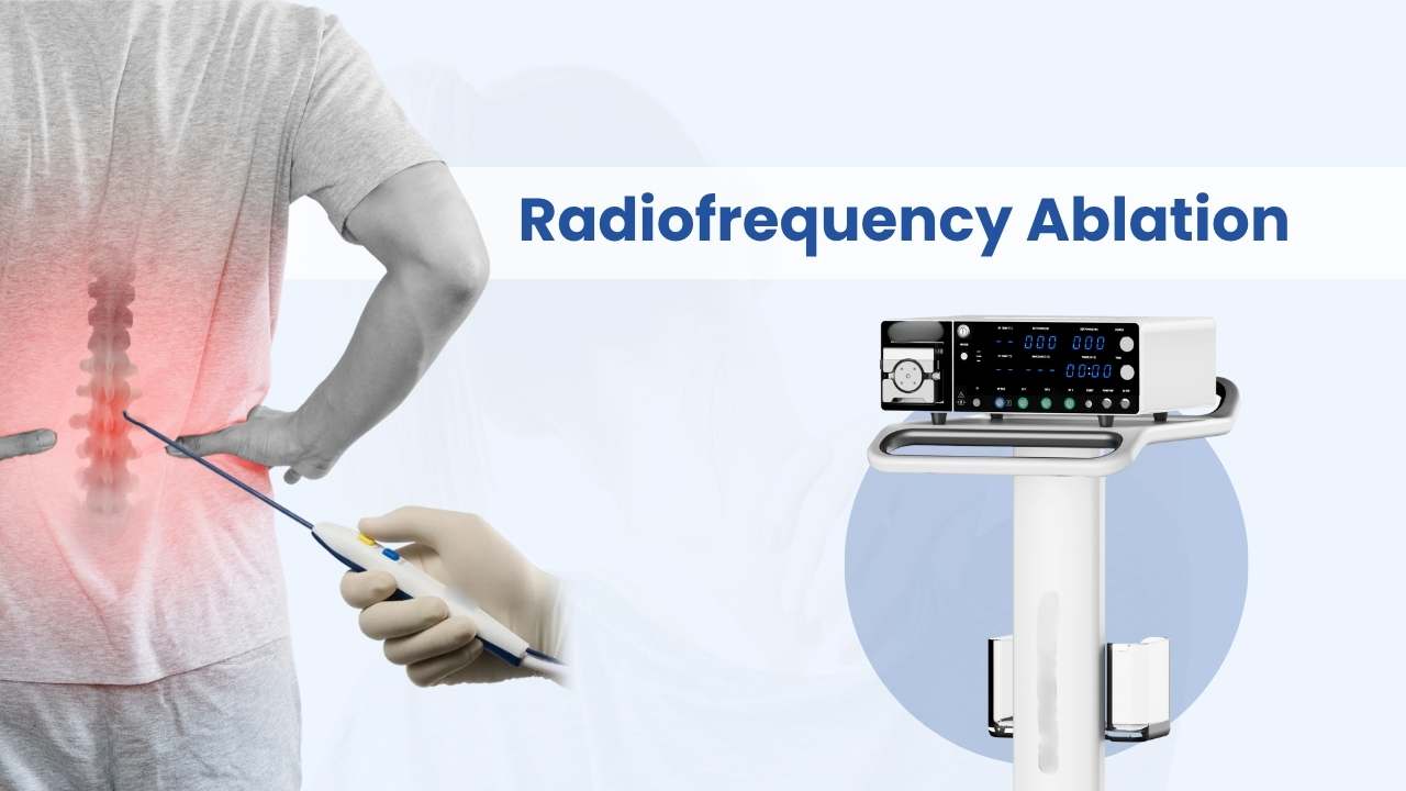 radiofrequency ablation