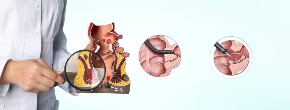 technologies used in fistula surgery in india