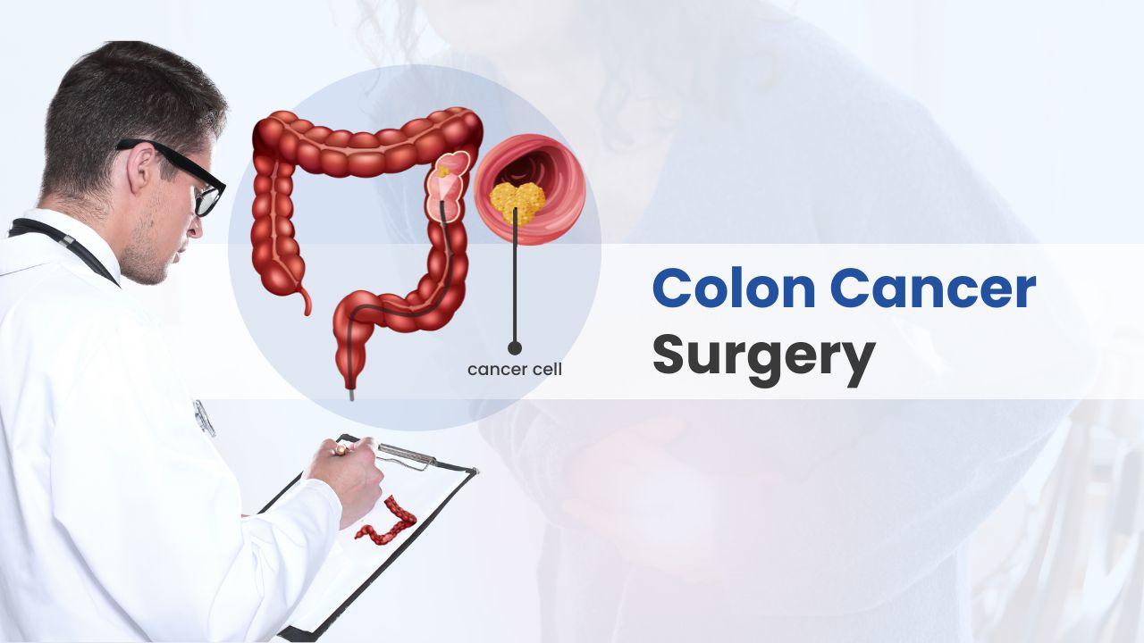 colon cancer surgery cost in india