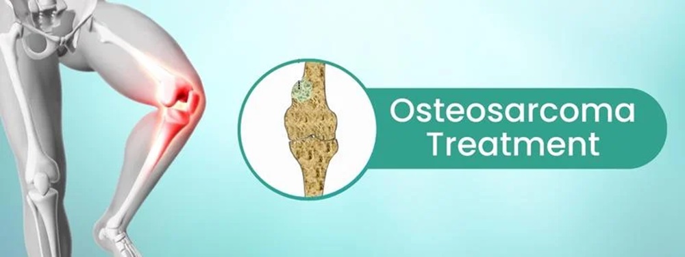osteosarcoma treatment cost in india