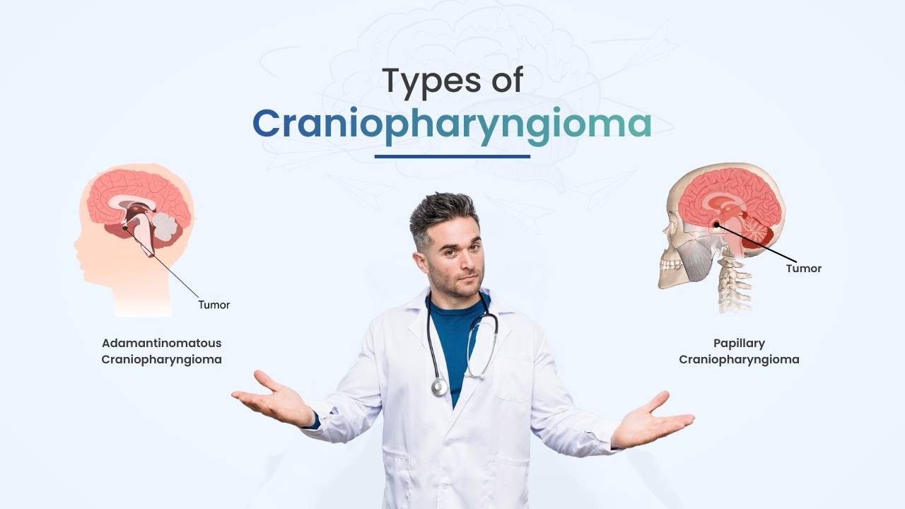 what are the types of craniopharyngioma