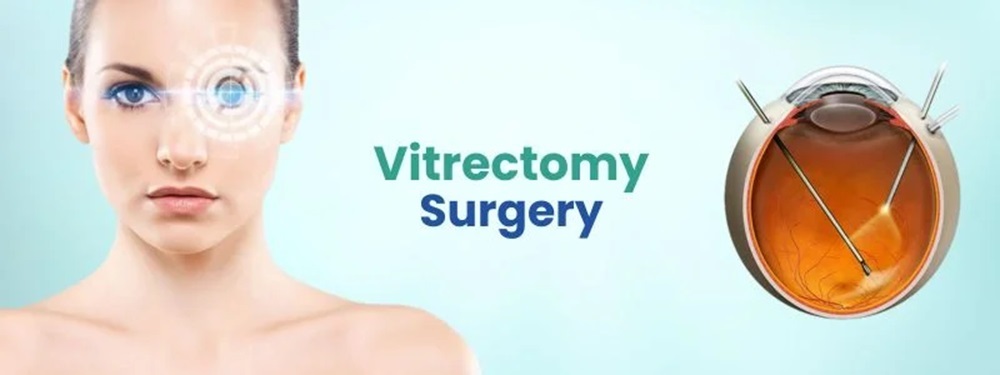 vitrectomy surgery cost in india