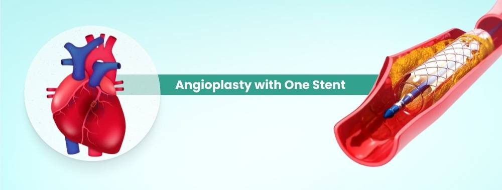 angioplasty with one stent cost in india