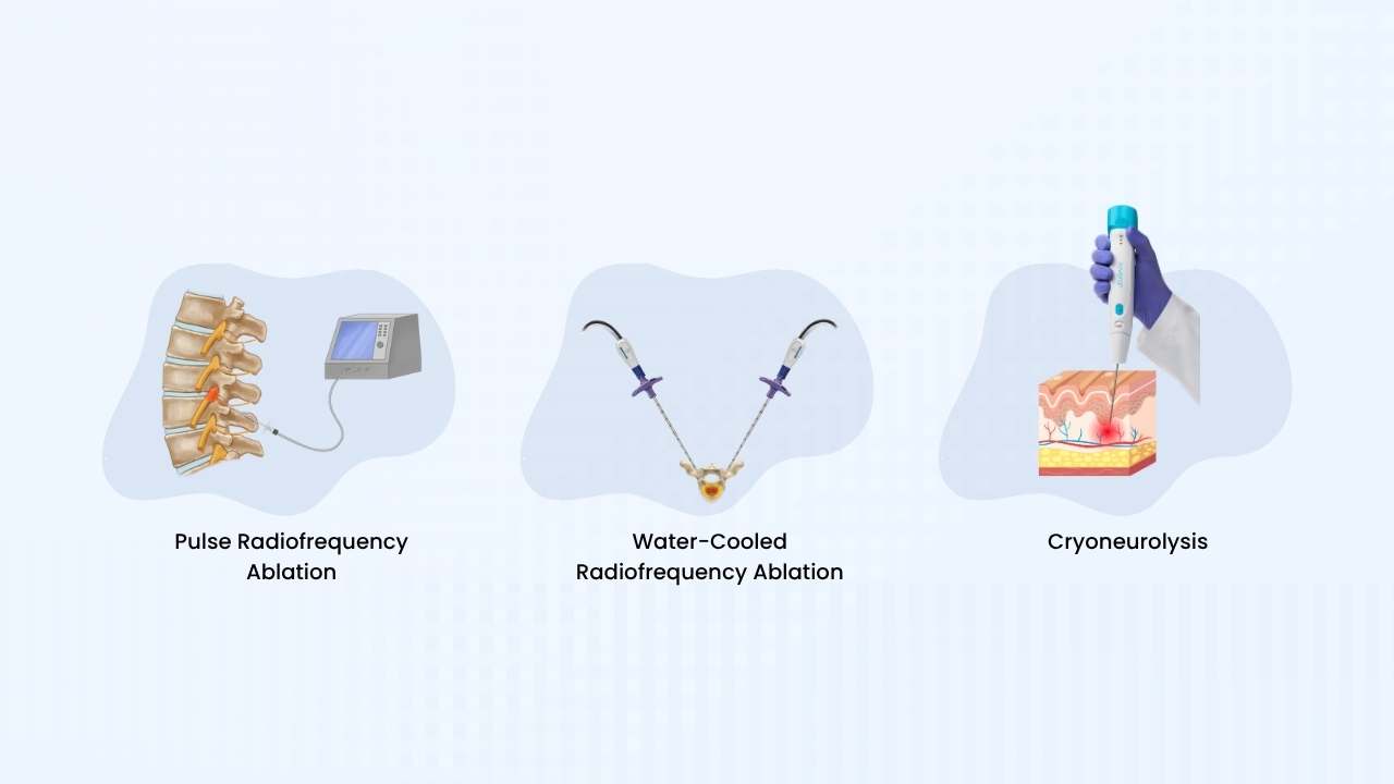 types of radiofrequency ablation procedures