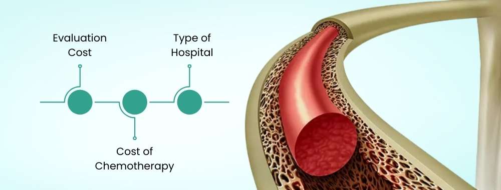 factors affecting the cost of bone marrow transplant in india