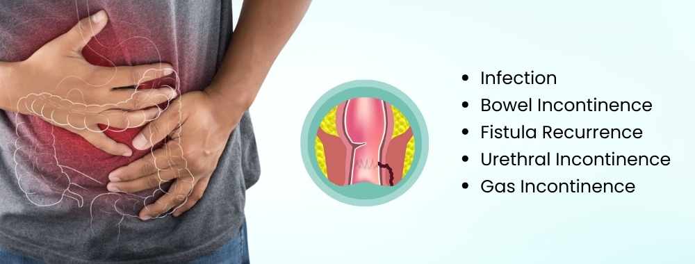 complication and risk of fistula surgery