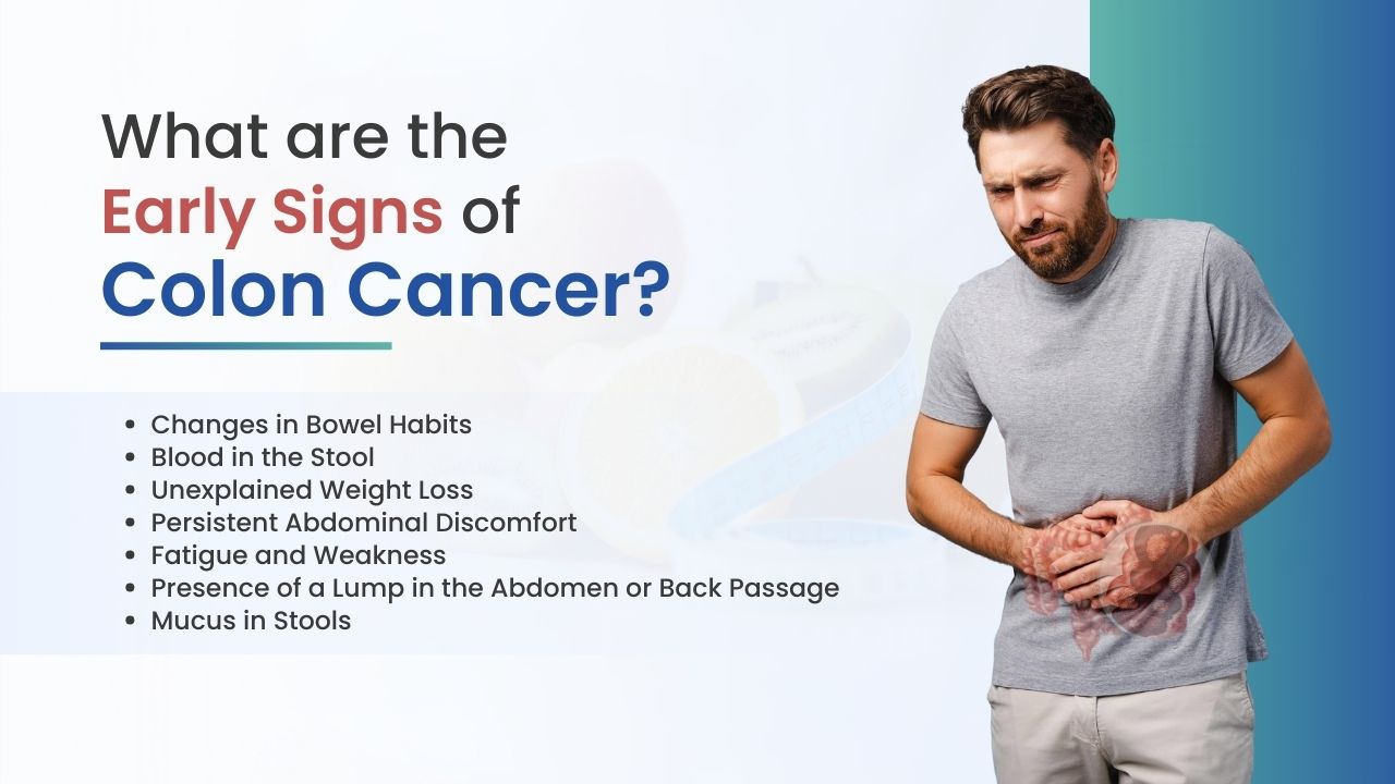 How I Knew I Had Colon Cancer: Early Signs & Symptoms