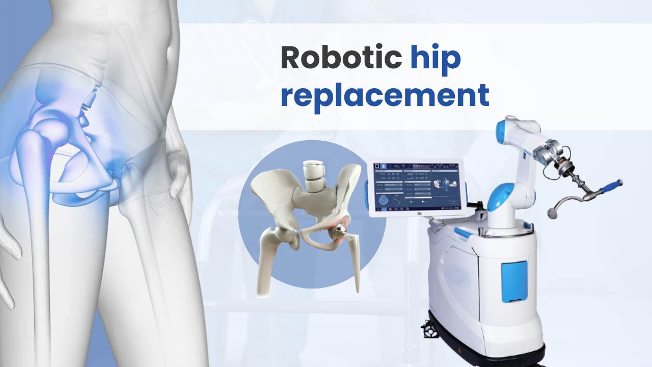 robotic hip replacement cost in india