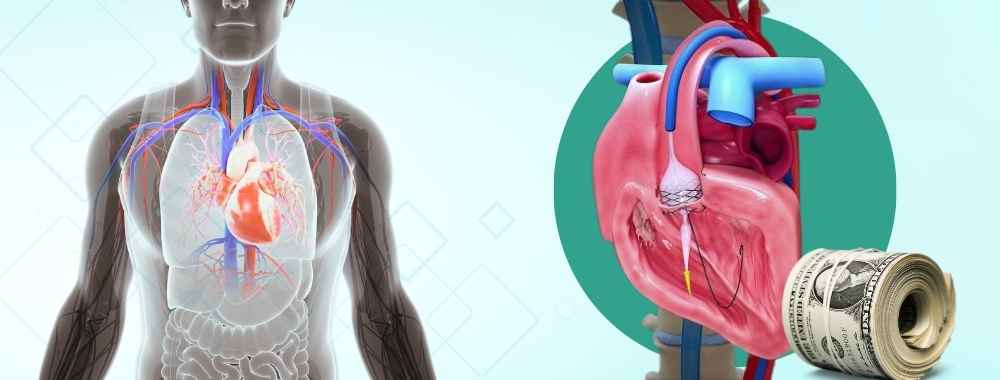 factors affecting the cost of heart valve replacement surgery