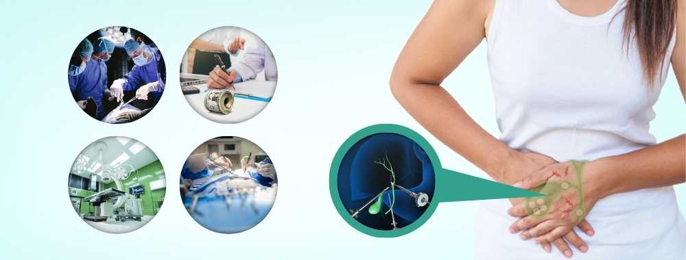 factors affect the cost of gallbladder surgery in india