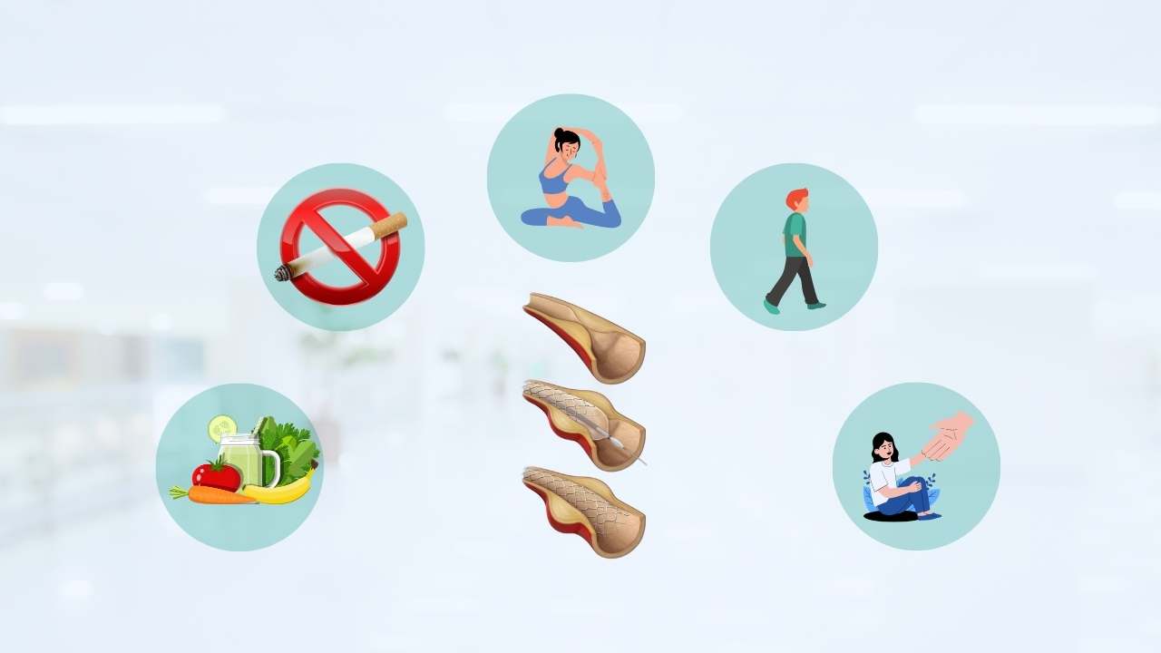 how to stay fit after angioplasty