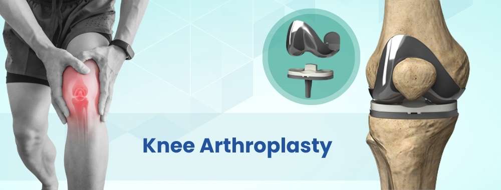 knee arthroplasty cost in india