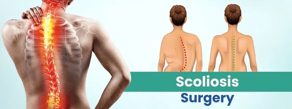 scoliosis surgery cost in india