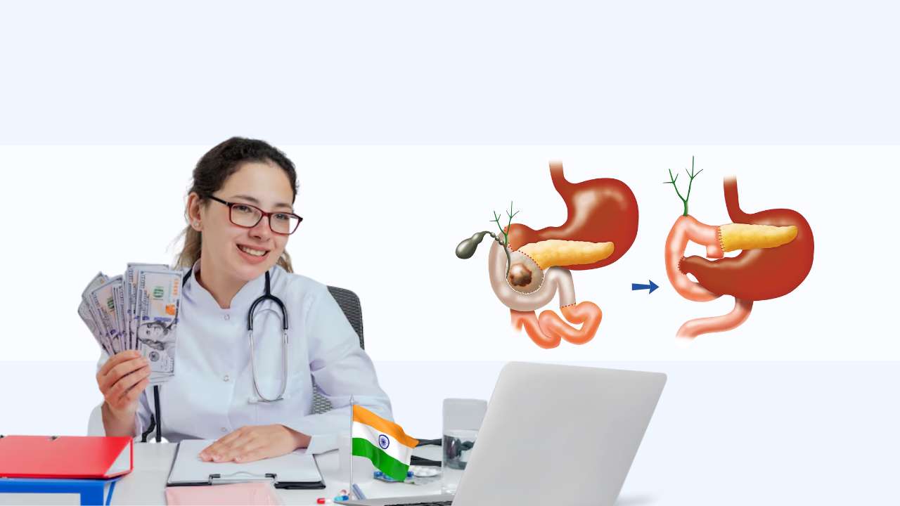 factors affecting the overall cost of whipple surgery in india