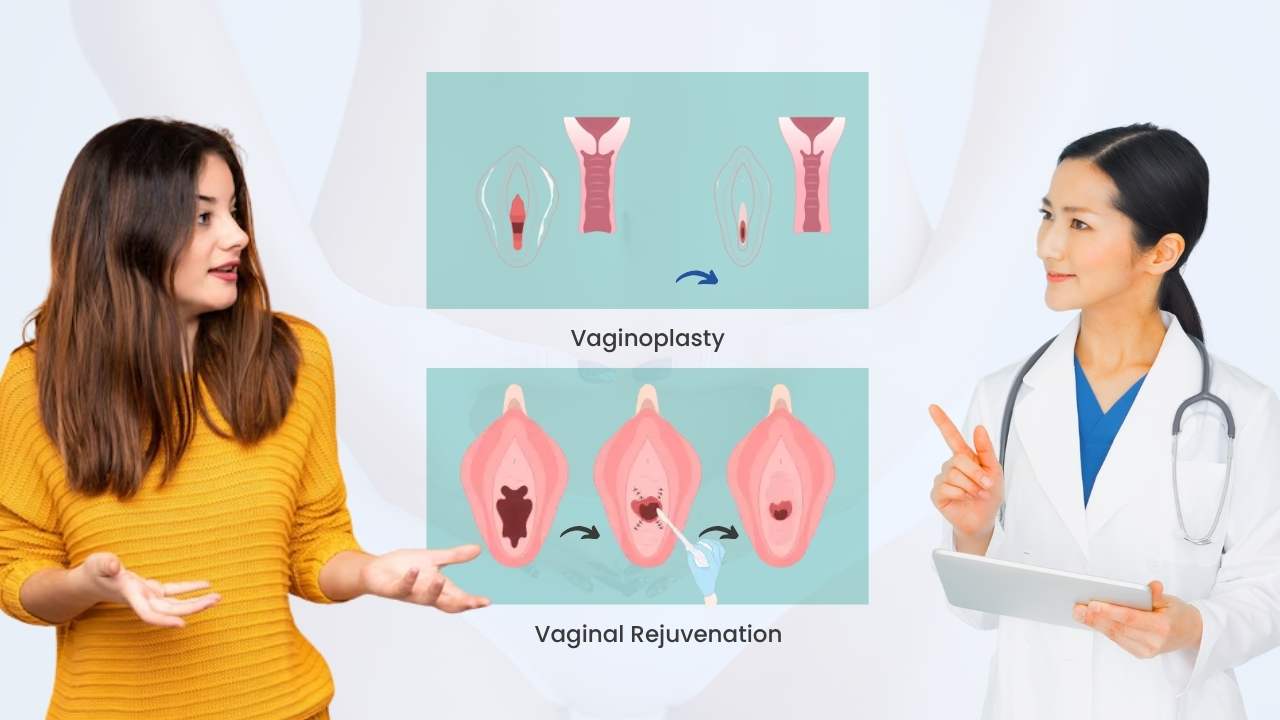is vagionoplasty the same as vagina rejuvenation