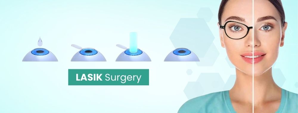 lasik surgery cost in india