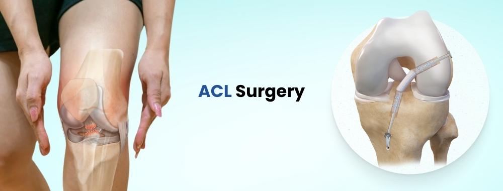 acl surgery cost in india