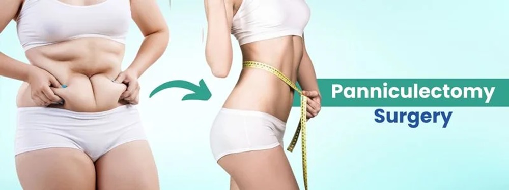 panniculectomy cost in india