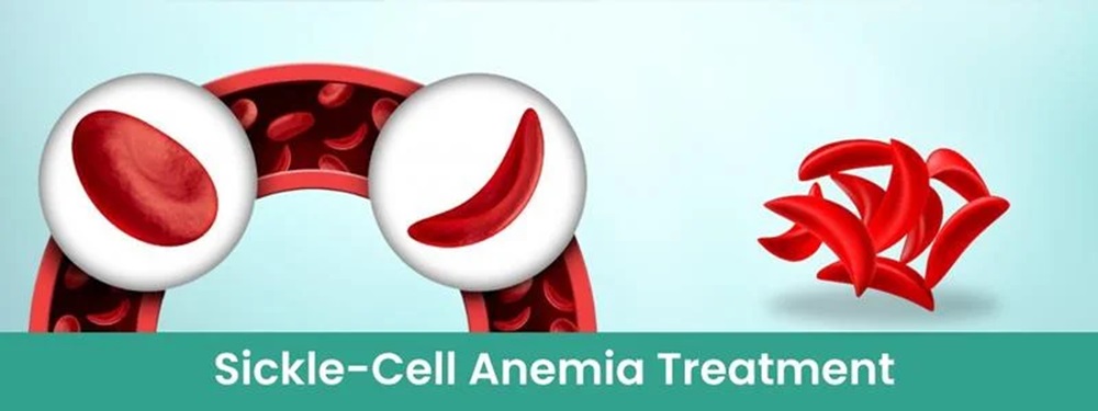 sickle cell anemia treatment cost in india