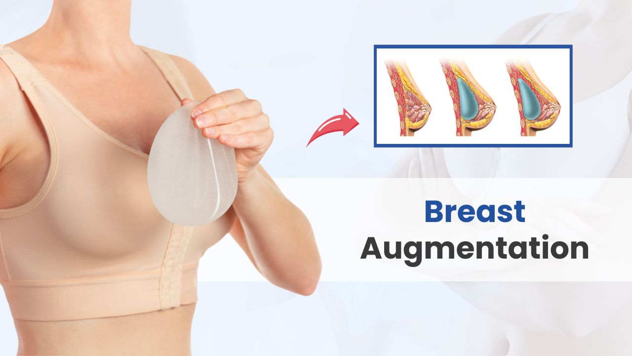 breast augmentation cost in india