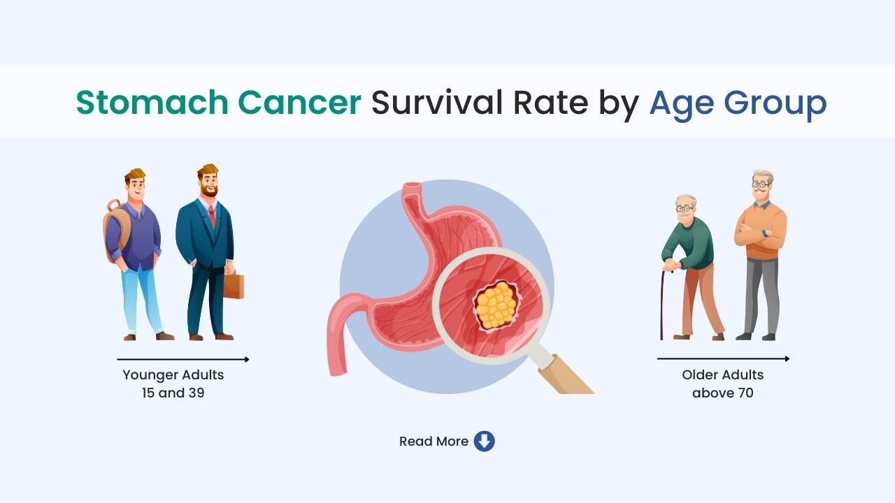 Stomach Cancer Survival Rate by Age | Gastric Cancer