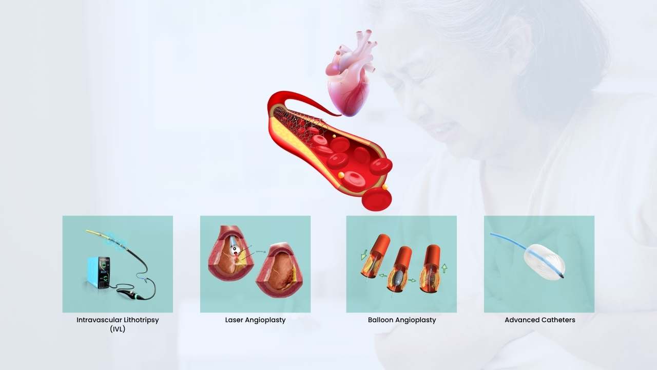 technologies used for angioplasty in india