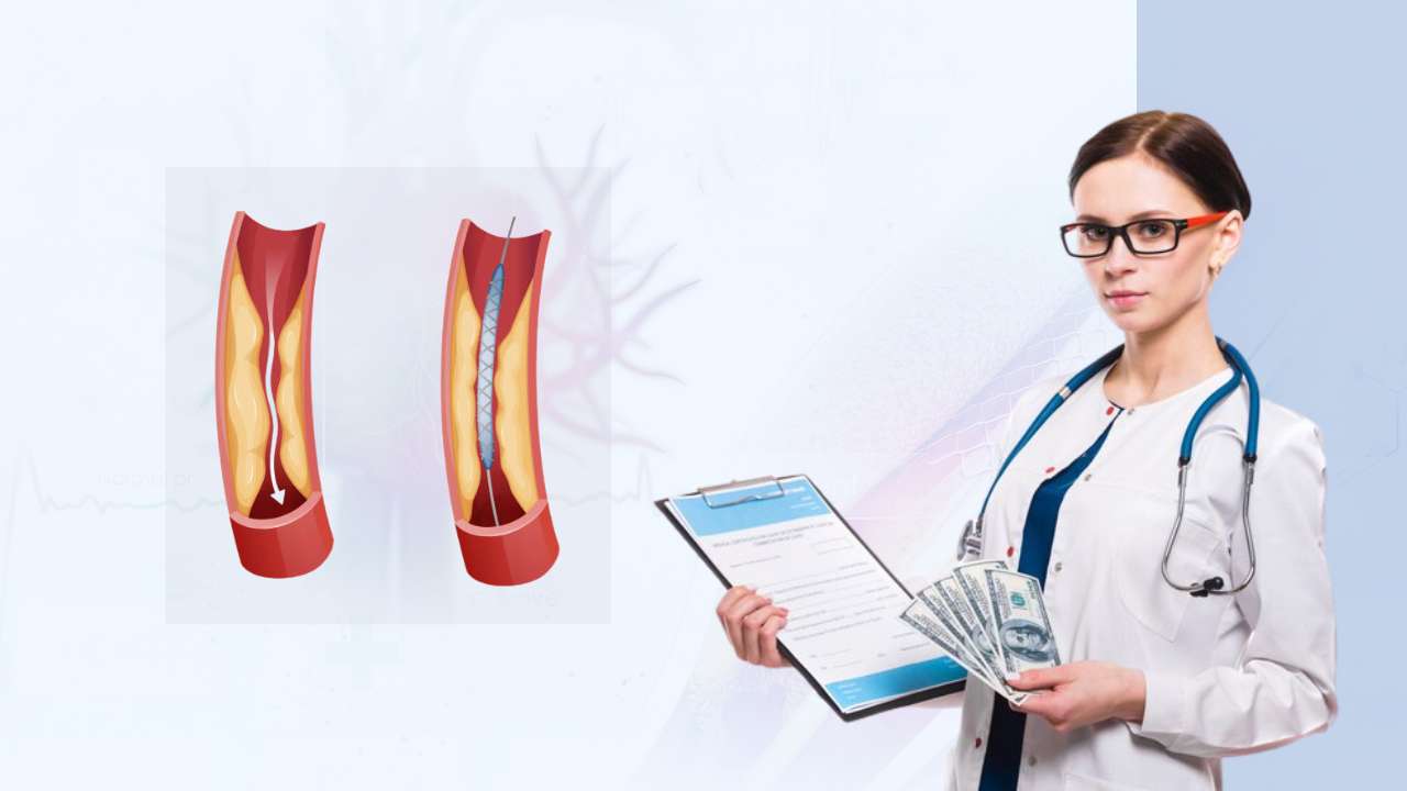 important factors that influence the cost of heart stent in india