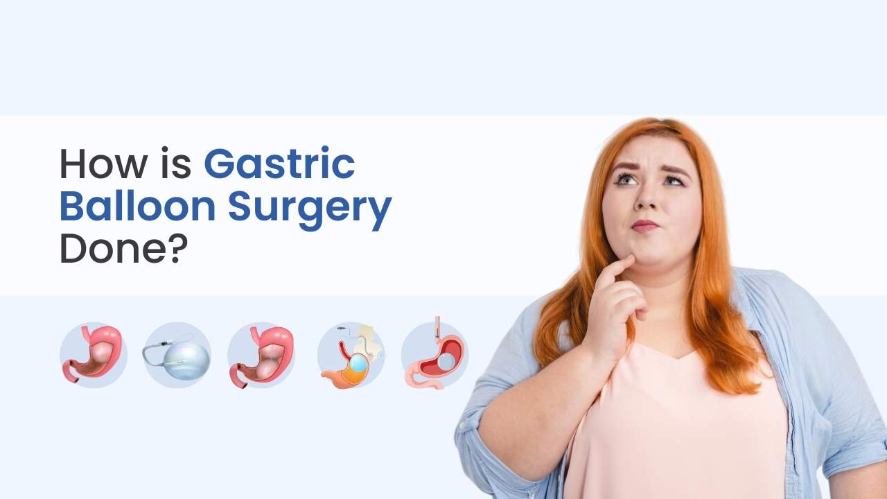 how is gastric balloon done?