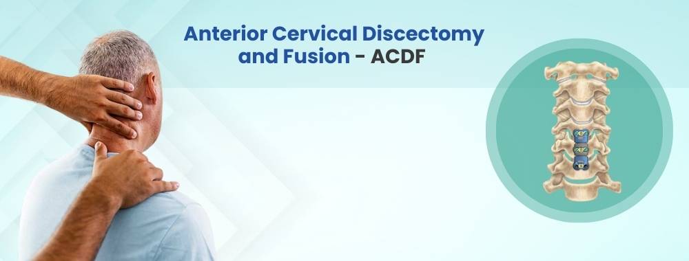 anterior cervical discectomy and fusion - acdf cost in india