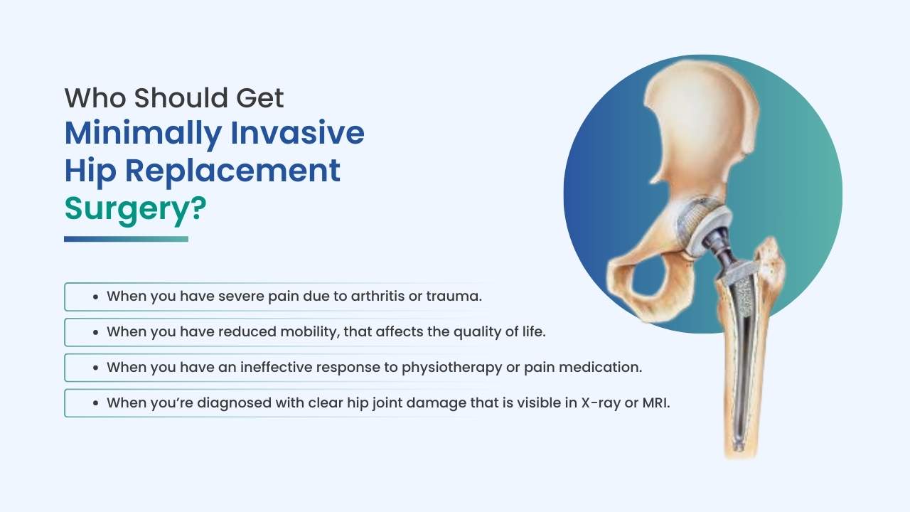 who should get minimally invasive hip replacement surgery