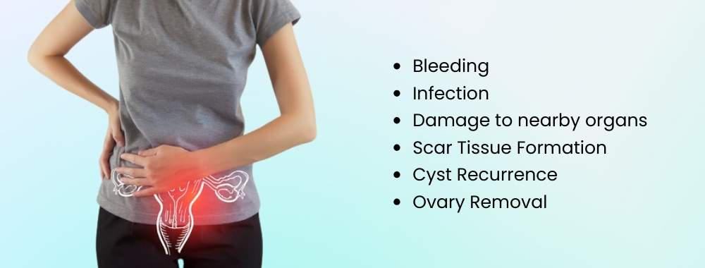 risks and complications management in ovarian cyst removal surgery