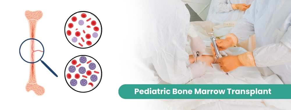 pediatric bone marrow transplant cost in india