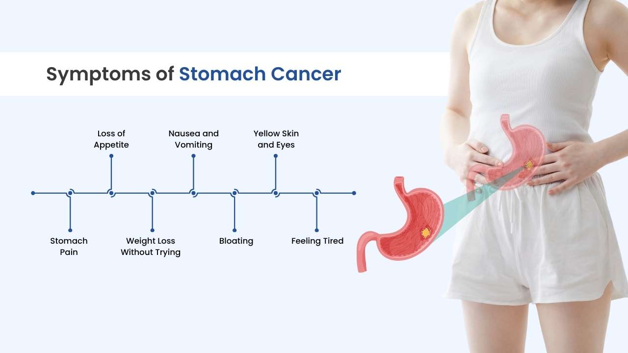 what are the symptoms of stomach cancer treatment